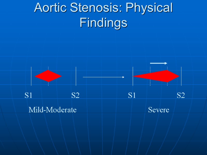 Aortic Stenosis: Physical Findings S1         